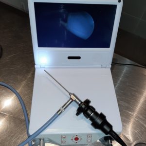 fotka monitoru endoskopu